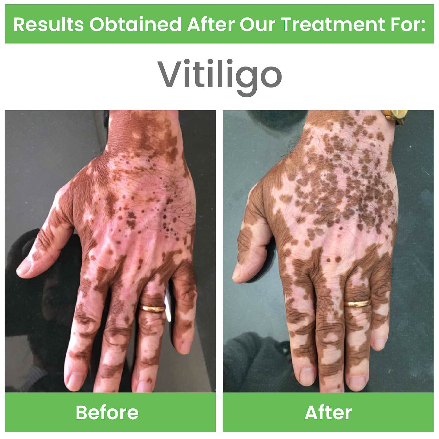 before and after