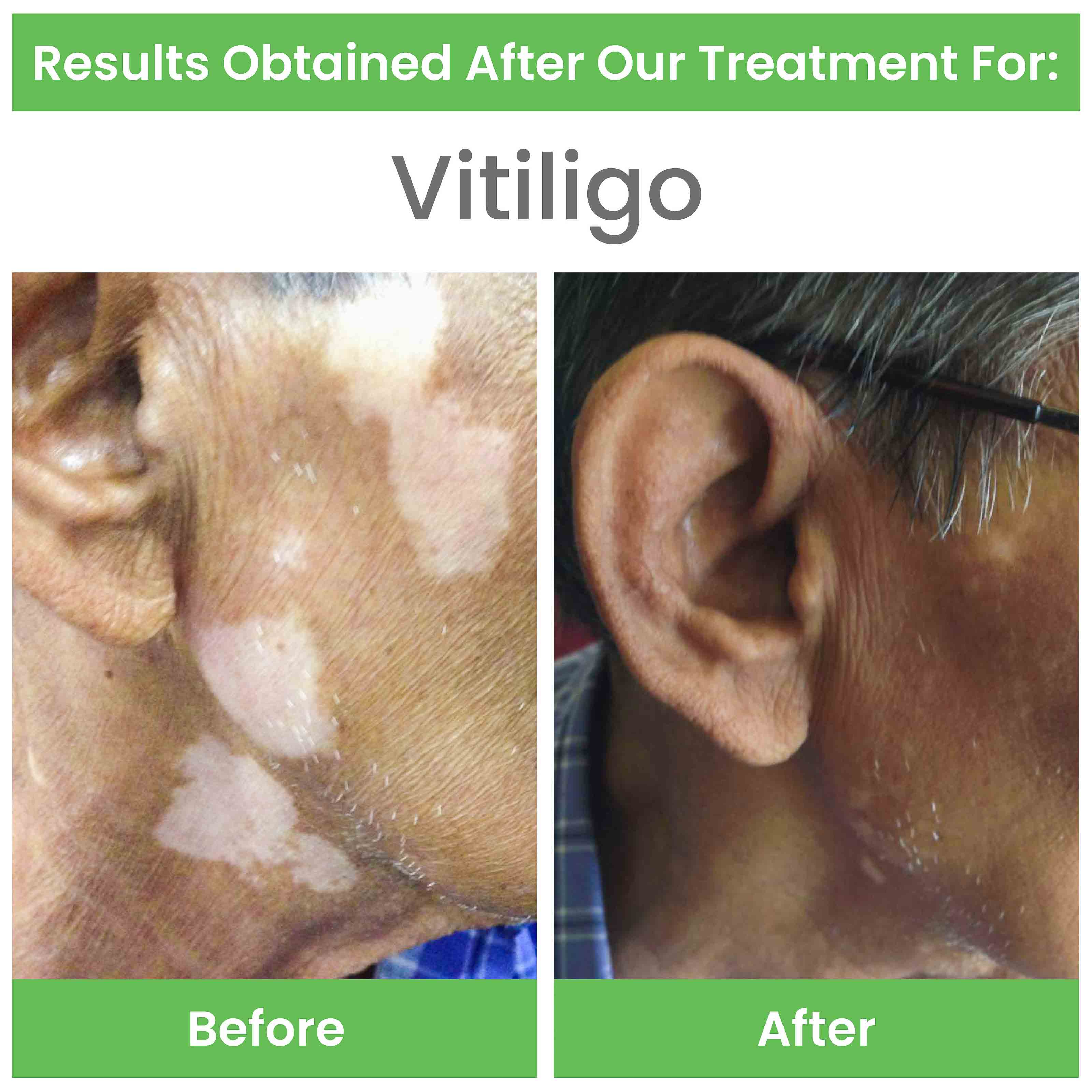 before and after