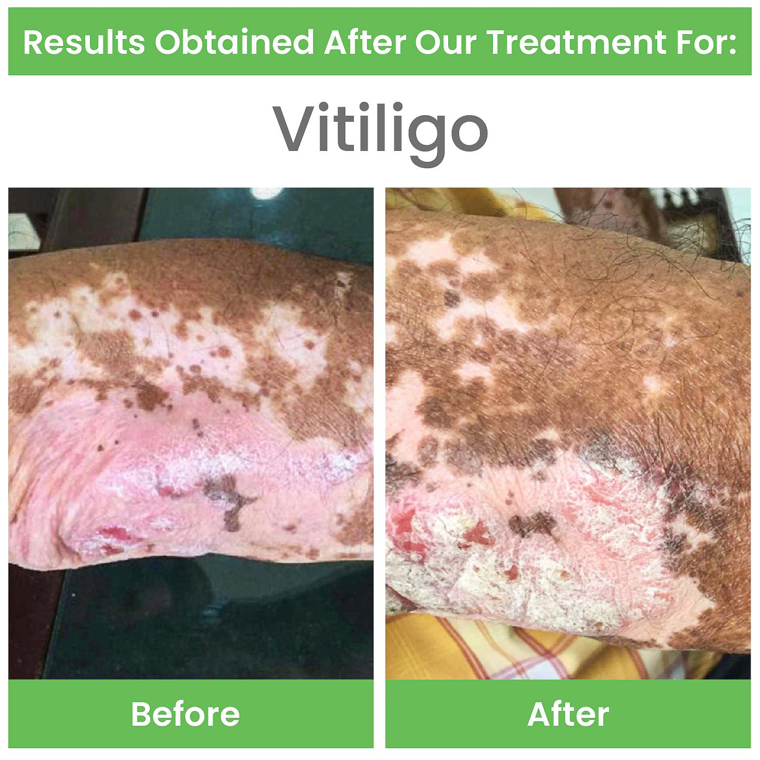 before and after