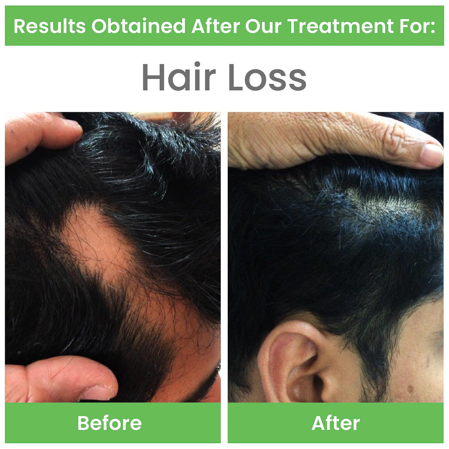 before-after-13
