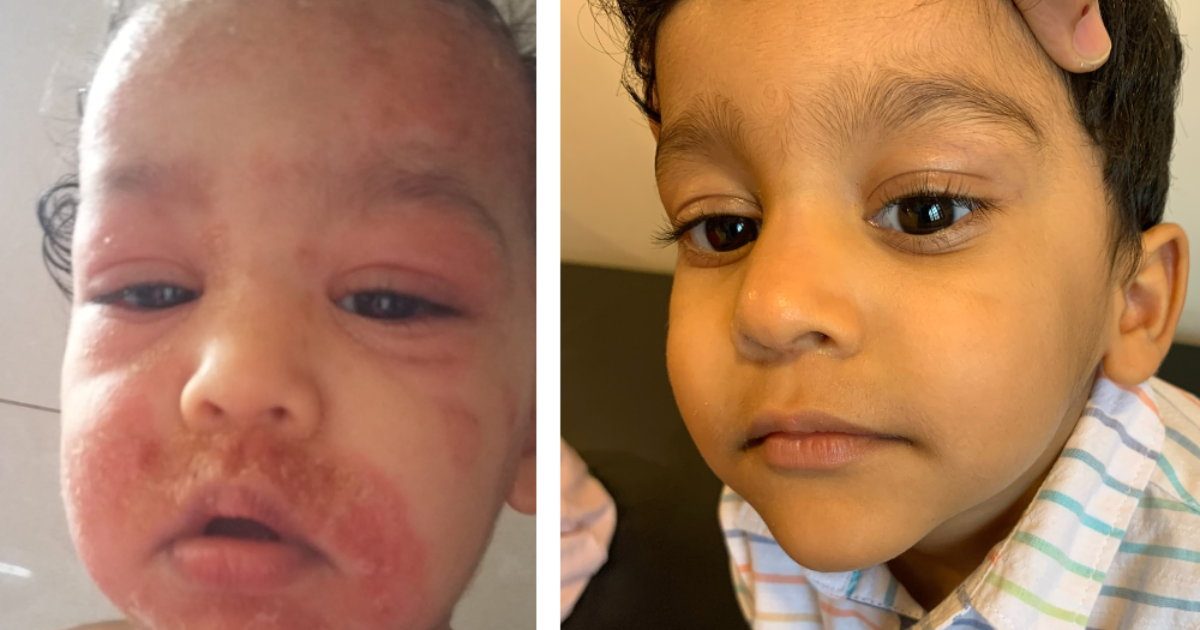 before - after images